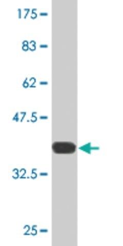 Monoclonal Anti-SNPH antibody produced in mouse