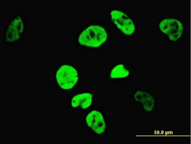 Monoclonal Anti-TCF7L2 antibody produced in mouse