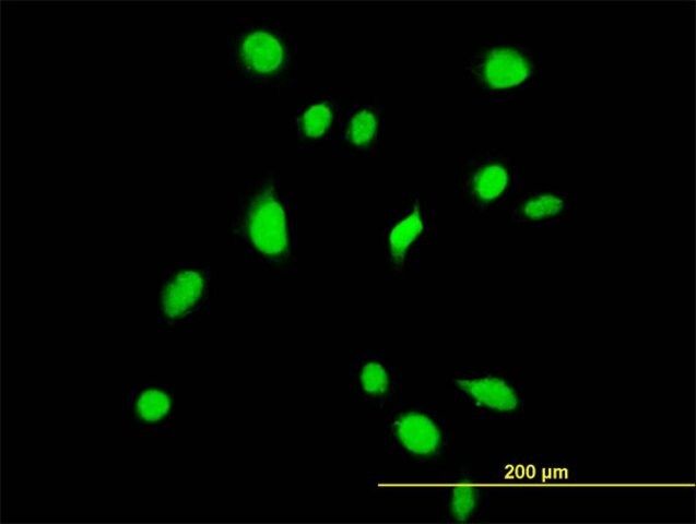 Monoclonal Anti-TBX6 antibody produced in mouse