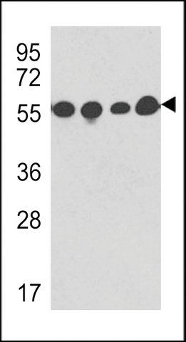 MONOCLONAL ANTI-TBB5 antibody produced in mouse