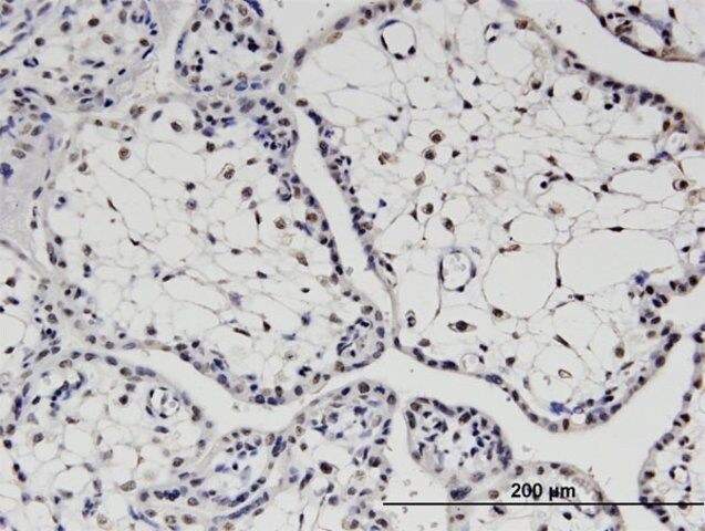 Monoclonal Anti-TBX22, (C-terminal) antibody produced in mouse