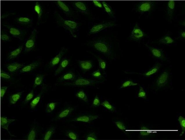 Monoclonal Anti-TBL1XR1 antibody produced in mouse