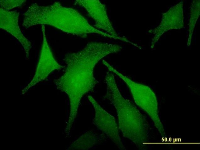 Monoclonal Anti-SNX6 antibody produced in mouse