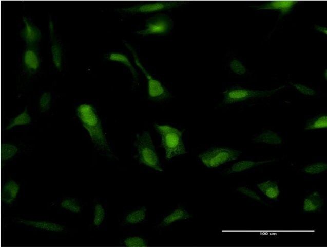 Monoclonal Anti-SOD1 antibody produced in mouse