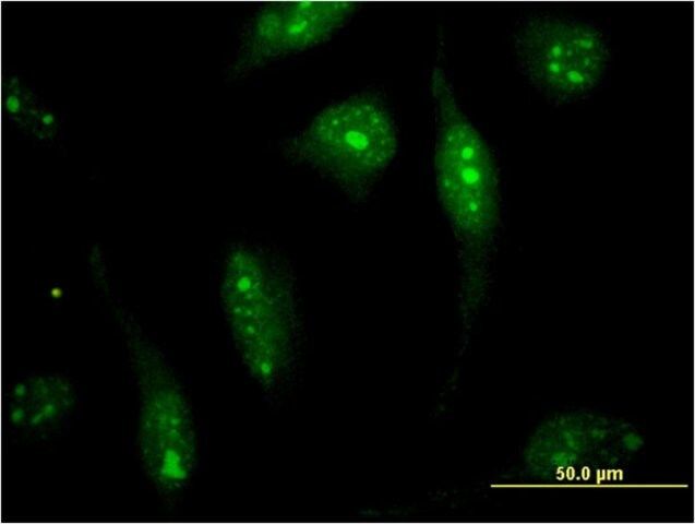 Monoclonal Anti-SOLH antibody produced in mouse