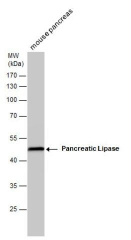 Monoclonal Anti-Pancreatic Lipase antibody produced in mouse