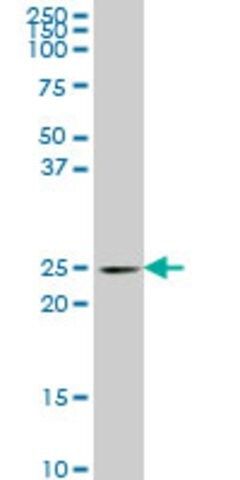 Monoclonal Anti-PCMT1 antibody produced in mouse