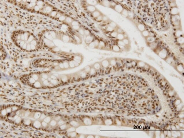 Monoclonal Anti-OXSR1 antibody produced in mouse