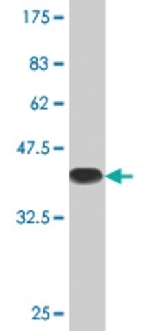 Monoclonal Anti-PCGF2 antibody produced in mouse