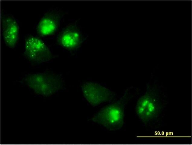 Monoclonal Anti-PHLDA1, (N-terminal) antibody produced in mouse