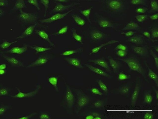 Monoclonal Anti-PCYT1A antibody produced in mouse