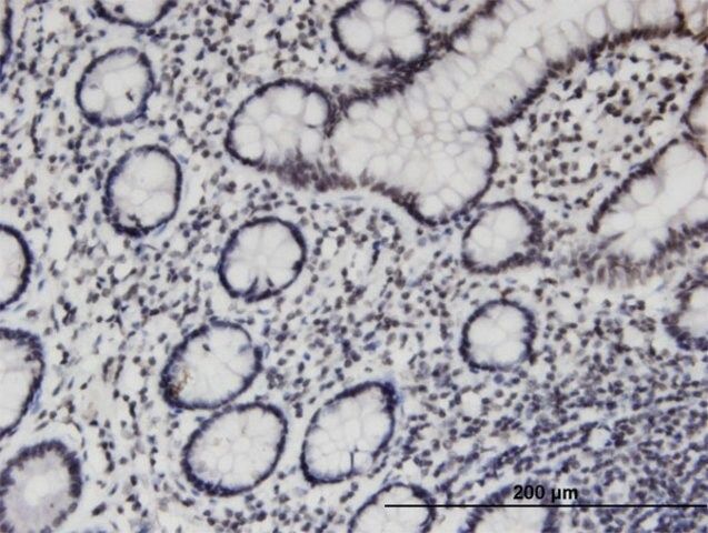 Monoclonal Anti-PCGF3, (C-terminal) antibody produced in mouse