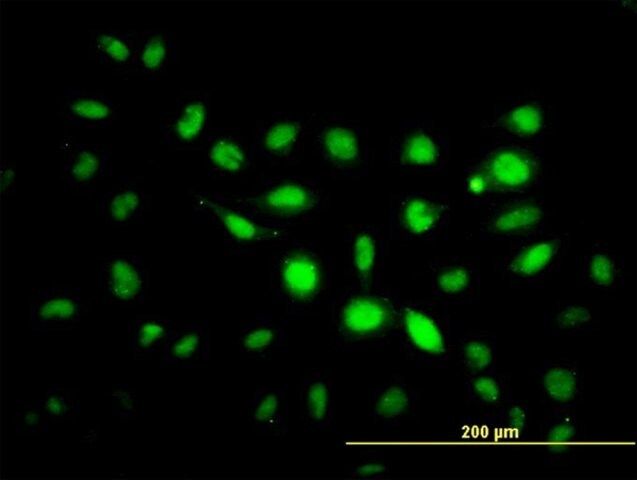 Monoclonal Anti-PHF1 antibody produced in mouse