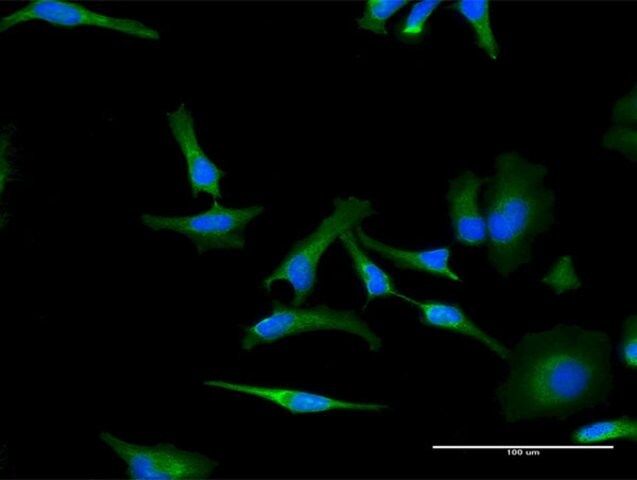 Monoclonal Anti-PHB antibody produced in mouse