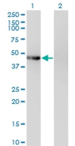 Monoclonal Anti-PHKG2 antibody produced in mouse