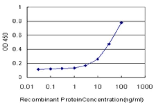 Monoclonal Anti-PHKG2 antibody produced in mouse