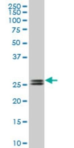 Monoclonal Anti-PHOSPHO1, (C-terminal) antibody produced in mouse