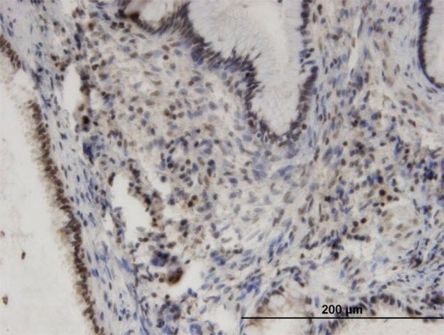 Monoclonal Anti-PHKA2 antibody produced in mouse