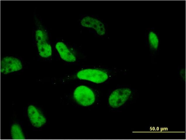 Monoclonal Anti-PHF11 antibody produced in mouse