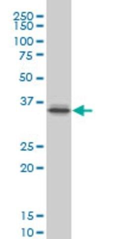 Monoclonal Anti-PITX1, (C-terminal) antibody produced in mouse