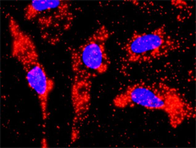 Monoclonal Anti-PIAS1, (C-terminal) antibody produced in mouse