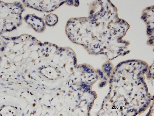 Monoclonal Anti-PIGQ antibody produced in mouse