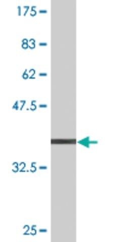 Monoclonal Anti-PHTF1 antibody produced in mouse