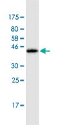 Monoclonal Anti-PIP5K3, (C-terminal) antibody produced in mouse