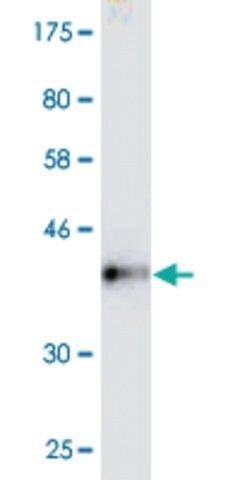 Monoclonal Anti-PIBF1 antibody produced in mouse