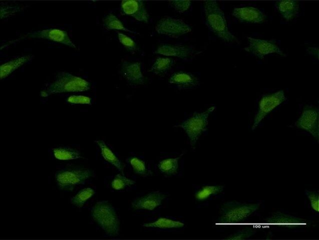 Monoclonal Anti-PRKRIP1 antibody produced in mouse