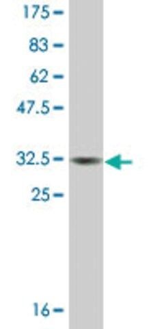 Monoclonal Anti-MT3 antibody produced in mouse