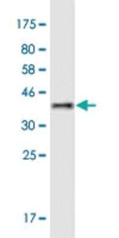 Monoclonal Anti-MYLK4 antibody produced in mouse