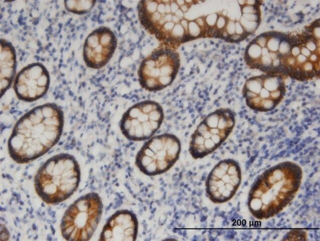 Monoclonal Anti-NTE, (C-terminal) antibody produced in mouse