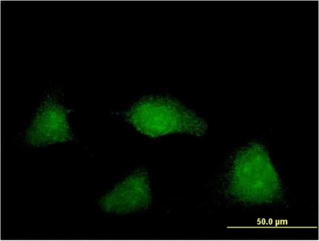 Monoclonal Anti-NUAK2 antibody produced in mouse