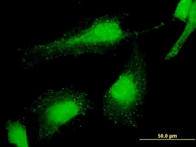 Monoclonal Anti-PCGF6 antibody produced in mouse