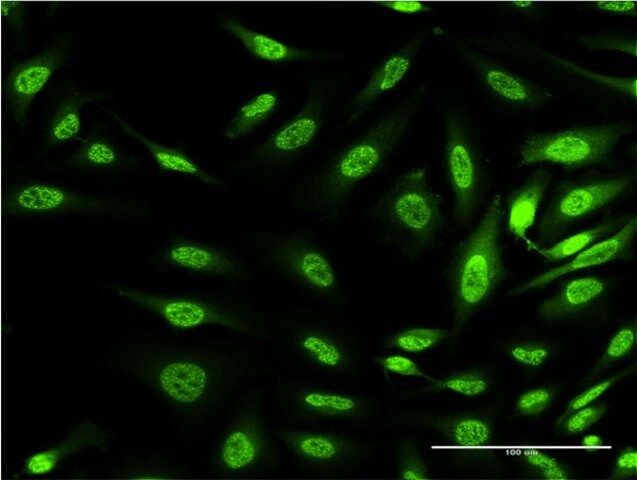 Monoclonal Anti-OXSR1 antibody produced in mouse