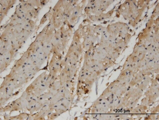 Monoclonal Anti-PANK4, (C-terminal) antibody produced in mouse