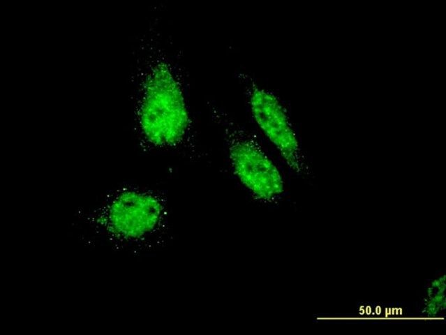 Monoclonal Anti-OTEX, (N-terminal) antibody produced in mouse