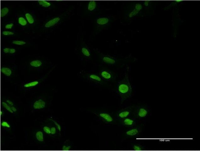 Monoclonal Anti-PARP1, (N-terminal) antibody produced in mouse