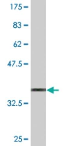 Monoclonal Anti-OSMR antibody produced in mouse