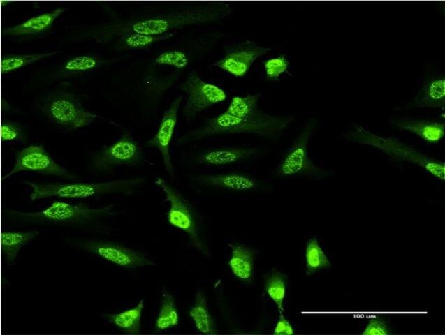 Monoclonal Anti-OXSR1 antibody produced in mouse