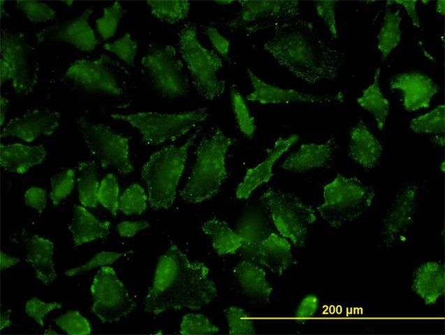 Monoclonal Anti-OXSR1 antibody produced in mouse