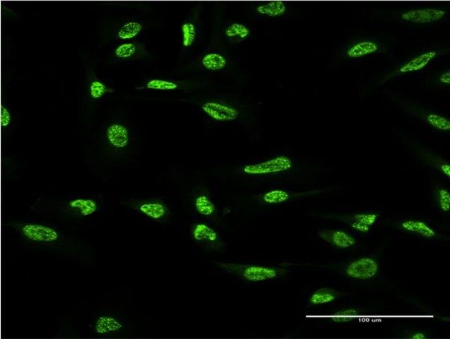 Monoclonal Anti-OXSR1 antibody produced in mouse