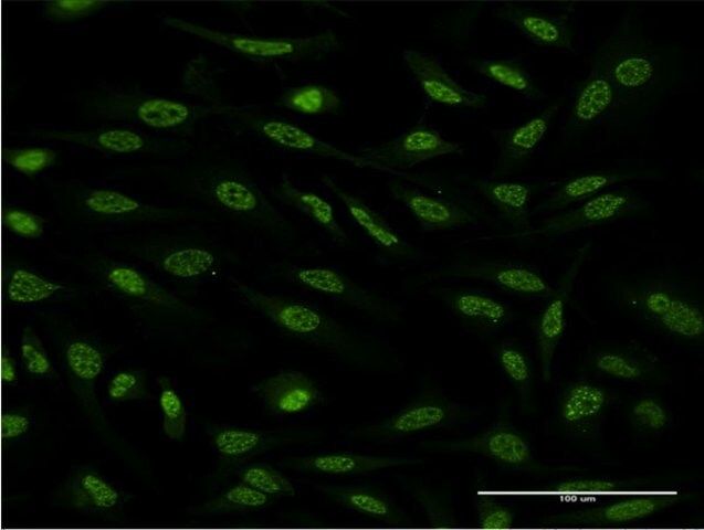 Monoclonal Anti-OXSR1 antibody produced in mouse