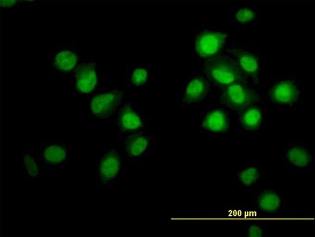 Monoclonal Anti-OXSR1 antibody produced in mouse