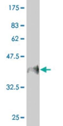 Monoclonal Anti-MUC5B antibody produced in mouse