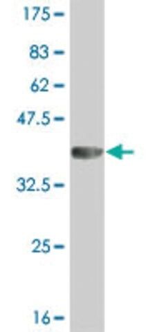 Monoclonal Anti-IRAK2 antibody produced in mouse