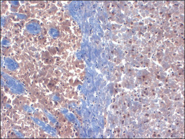 Monoclonal Anti-KCNIP3 antibody produced in mouse