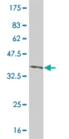 Monoclonal Anti-IRAK2 antibody produced in mouse