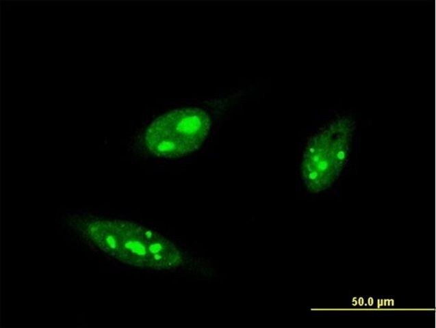 Monoclonal Anti-IRF4, (C-terminal) antibody produced in mouse